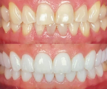 LP - OdontoSec3img4