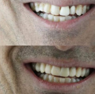 LP - OdontoSec3img5